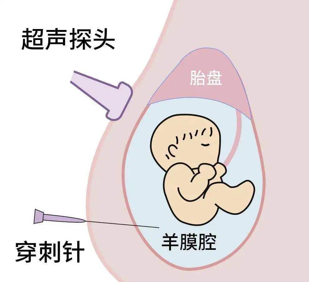 黄石羊水胎儿亲子鉴定